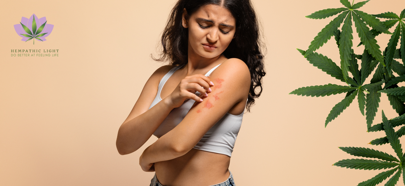 Muhera coçar o braço com marcas de alergia na pele. Folhas de canábis/cânhamo ao lado direito